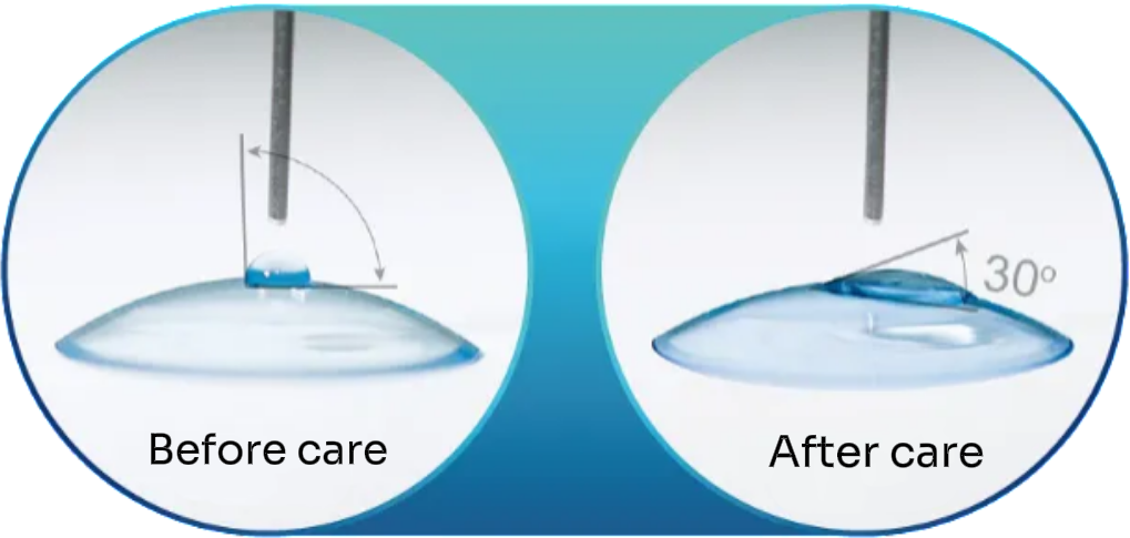 Application of plasma cleaning technology for orthokeratology lenses (OK lenses)
