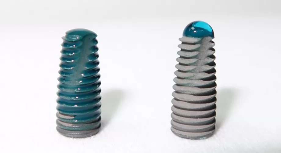 Low temperature plasma treatment improves the bonding strength of dentin